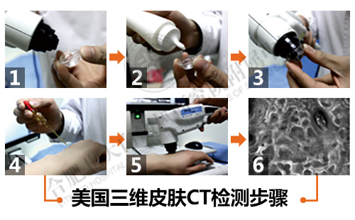 三維皮膚CT檢測系統