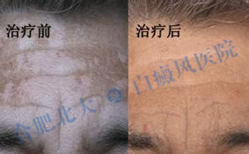 我終于不用做“白眉大俠”了